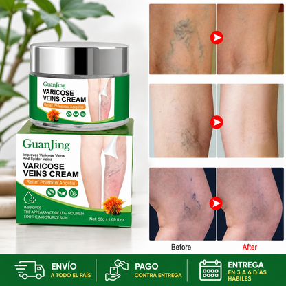 Crema para aliviar las venas varices