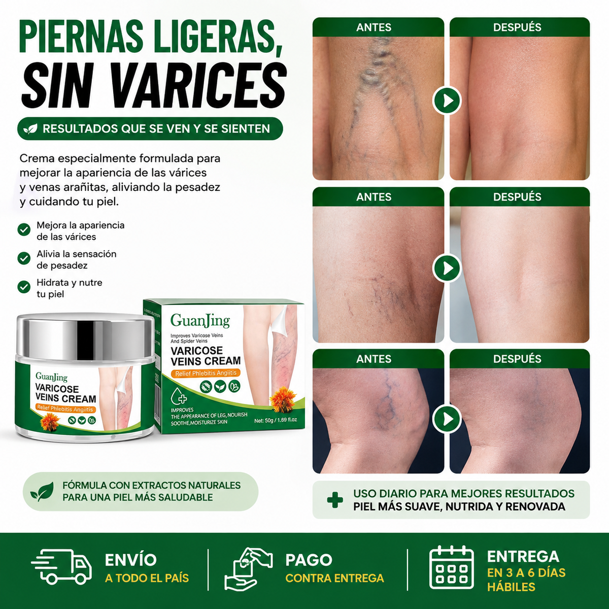 Crema para aliviar las venas varices